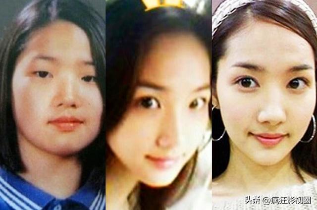朴敏英牙齿整容过程（韩国女星朴敏英的整容史）(16)