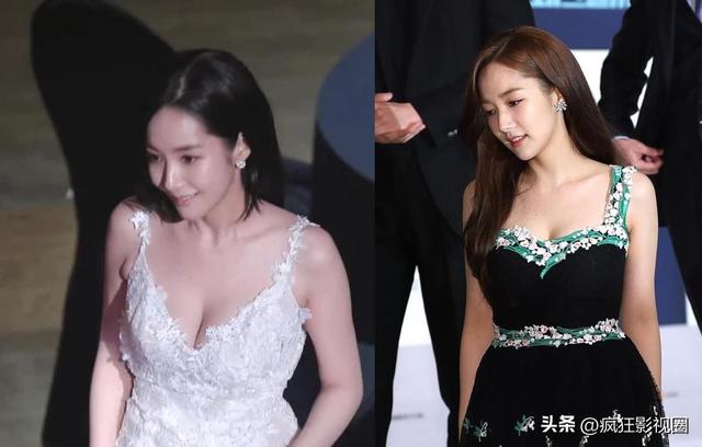 朴敏英牙齿整容过程（韩国女星朴敏英的整容史）(40)