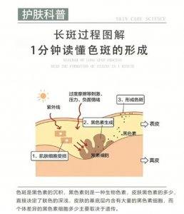 ​斑是怎么形成的（斑形成的原因）