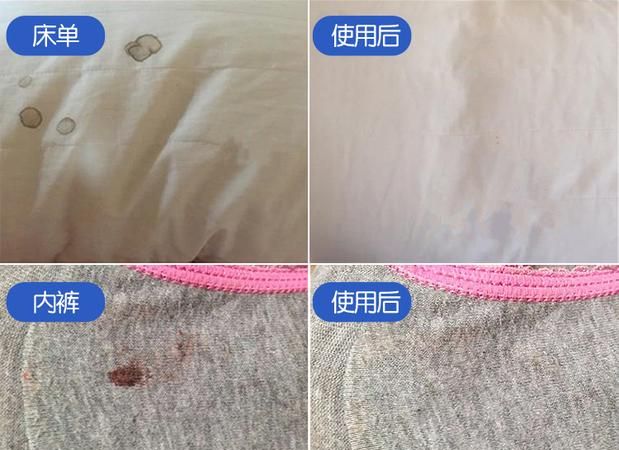 床单上的血迹怎么快速去除 这些方法都很管用