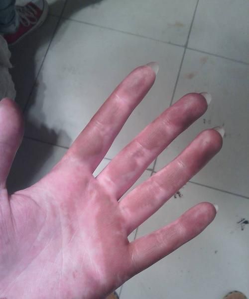 手沾沥青要用什么能洗掉