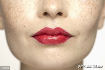​雀斑是怎么形成的 雀斑是怎么形成的？躲不开4个原因，斑点“爬上”脸