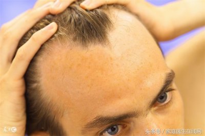 ​头发掉什么原因 脱发掉发离不开这13个原因！第3个多数人都避免不了