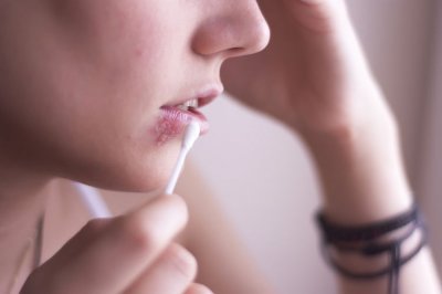 ​嘴角长泡怎么办最快的消除（嘴角长泡就是上火？错！是病毒在“捣乱”，这些治