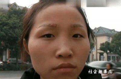 ​女子本来是激光洗眉 可如今纹眉不仅没洗掉还差点毁容