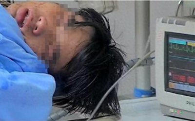 ​24岁男子百草枯中毒，死亡过程记录：临终前后悔，家人却放弃治疗