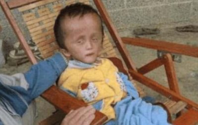 ​还记得喝了三鹿奶粉的“大头娃娃”吗？11年过去，他们现状如何？