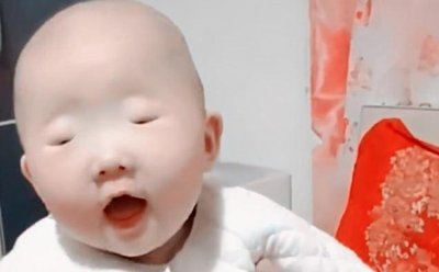 ​产妇生出“没眼”娃，医生检查后却哭笑不得，网友：翻版李荣浩？