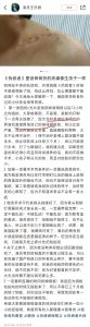 ​王乐君自曝拍戏时被胡歌砸断锁骨 自己找医院手术