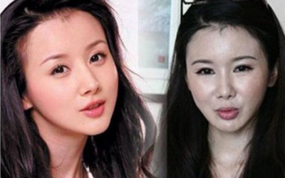 ​张翰回应郑爽整容，张翰会帮郑爽吗(郑爽张翰和好了吗)