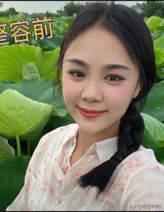 ​樊小慧整容后颜值大变,面对网友终于崩溃:肠子都悔青，不敢照镜子