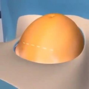 ​组图为你“播放”剖宫产的全过程，张张戳心，看完才知妈妈的不易