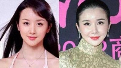 ​5位整容失败的女星，个个都是“假脸”，别再出来祸害观众了