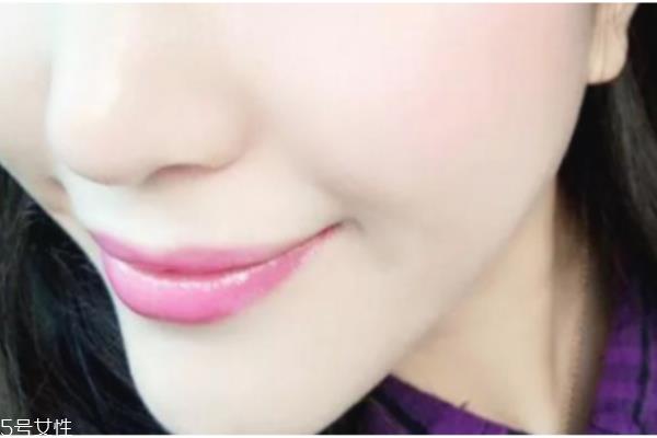 唇纹深是什么原因 教你轻松消除唇纹