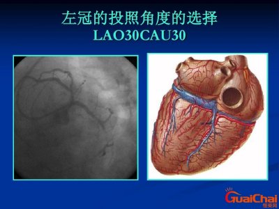 ​冠状动脉造影怎么做？冠状动脉造影是什么意思